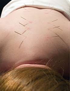 Alívio da dor é um dos principais motivos que levampacientes a procurarem um acupunturista (Foto: Cora Reed / Panthermedia)